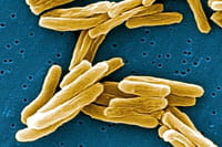 Desarrollan una nueva familia de antibióticos contra la tuberculosis