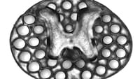 Implantes en 3D para problemas de médula