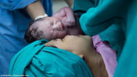 El remedio que salvará a miles de madres