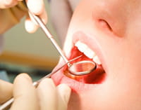 La periodontitis adquiere rango de factor de riesgo cardiovascular
