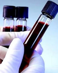 La OMS alerta sobre las donaciones de sangre remuneradas