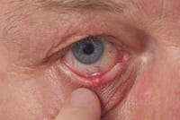 El maquillaje de mala calidad daña los ojos y la piel
