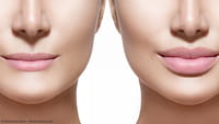 Cirugía estética para las redes sociales