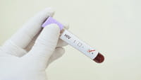 El virus VIH causa envejecimiento prematuro